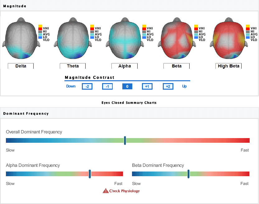 Brainwave Visual Reference